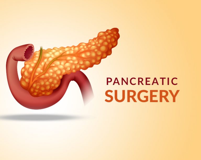 Pancreas Surgery - NYC General Surgeon - Best General Surgeons NYC